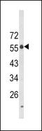 Lymphocyte Activating 3 antibody, LS-C165666, Lifespan Biosciences, Western Blot image 