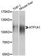 ATPase Na+/K+ Transporting Subunit Alpha 1 antibody, LS-C747510, Lifespan Biosciences, Western Blot image 