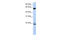 Chaperonin Containing TCP1 Subunit 5 antibody, 26-933, ProSci, Western Blot image 
