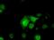 Serine Racemase antibody, MA5-25051, Invitrogen Antibodies, Immunocytochemistry image 