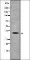 Olfactory Receptor Family 10 Subfamily Q Member 1 antibody, orb335645, Biorbyt, Western Blot image 