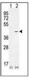 Twinfilin Actin Binding Protein 2 antibody, AP53503PU-N, Origene, Western Blot image 