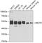 Methyl-CpG Binding Protein 2 antibody, 19-800, ProSci, Western Blot image 