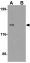 Zinc finger protein 521 antibody, GTX32072, GeneTex, Western Blot image 
