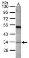 Protein Activator Of Interferon Induced Protein Kinase EIF2AK2 antibody, GTX114215, GeneTex, Western Blot image 