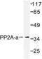 Protein Phosphatase 2 Catalytic Subunit Alpha antibody, LS-C176461, Lifespan Biosciences, Western Blot image 