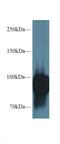 Periostin antibody, MBS2026316, MyBioSource, Western Blot image 