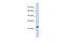 TATA-Box Binding Protein Associated Factor 12 antibody, A06944, Boster Biological Technology, Western Blot image 