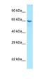 Collagen Type IX Alpha 1 Chain antibody, orb333730, Biorbyt, Western Blot image 