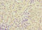 DCMP Deaminase antibody, LS-C675623, Lifespan Biosciences, Immunohistochemistry paraffin image 