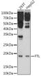 Ferritin Light Chain antibody, GTX55618, GeneTex, Western Blot image 