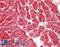 ATP Synthase F1 Subunit Beta antibody, LS-B12908, Lifespan Biosciences, Immunohistochemistry paraffin image 