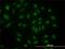 S-Phase Kinase Associated Protein 1 antibody, H00006500-M01, Novus Biologicals, Immunocytochemistry image 