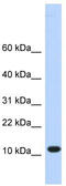 Transmembrane Protein 254 antibody, TA339545, Origene, Western Blot image 