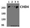 Chromodomain Helicase DNA Binding Protein 4 antibody, GTX66800, GeneTex, Western Blot image 