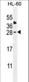 C-Type Lectin Domain Family 2 Member A antibody, LS-C168833, Lifespan Biosciences, Western Blot image 