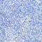 Cathepsin B antibody, 13-341, ProSci, Immunohistochemistry paraffin image 