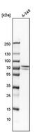 Glucosamine (UDP-N-Acetyl)-2-Epimerase/N-Acetylmannosamine Kinase antibody, NBP1-81621, Novus Biologicals, Western Blot image 