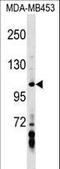 Axin 1 antibody, LS-C159144, Lifespan Biosciences, Western Blot image 