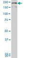 Dedicator Of Cytokinesis 4 antibody, H00009732-M03, Novus Biologicals, Western Blot image 