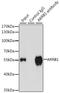 Arrestin Beta 1 antibody, 13-363, ProSci, Immunoprecipitation image 