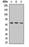 Metastasis Associated 1 Family Member 3 antibody, LS-C668374, Lifespan Biosciences, Western Blot image 