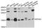 Eukaryotic Translation Initiation Factor 5A2 antibody, A4864, ABclonal Technology, Western Blot image 