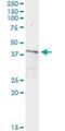 Protein Phosphatase 1 Regulatory Subunit 8 antibody, H00005511-M05, Novus Biologicals, Immunoprecipitation image 