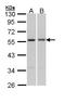 Paired Box 6 antibody, LS-C109502, Lifespan Biosciences, Western Blot image 