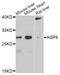 Aquaporin 8 antibody, A8539, ABclonal Technology, Western Blot image 