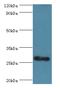 RNA Transcription, Translation And Transport Factor antibody, MBS1497423, MyBioSource, Western Blot image 