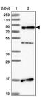 Serine/Arginine Repetitive Matrix 5 antibody, NBP1-94187, Novus Biologicals, Western Blot image 