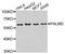 Palmdelphin antibody, abx003635, Abbexa, Western Blot image 
