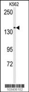 Transient Receptor Potential Cation Channel Subfamily M Member 7 antibody, 63-367, ProSci, Western Blot image 