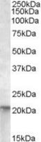 Ras antibody, PA5-18888, Invitrogen Antibodies, Western Blot image 