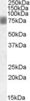 NUAK Family Kinase 1 antibody, STJ71529, St John