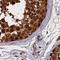 NEDD8 Activating Enzyme E1 Subunit 1 antibody, NBP1-92162, Novus Biologicals, Immunohistochemistry paraffin image 