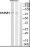 NIMA Related Kinase 5 antibody, PA5-39439, Invitrogen Antibodies, Western Blot image 