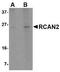 Regulator Of Calcineurin 2 antibody, TA306733, Origene, Western Blot image 