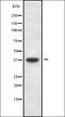 Ubiquitin Specific Peptidase 3 antibody, orb338784, Biorbyt, Western Blot image 