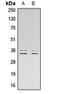 Linker For Activation Of T Cells antibody, orb315587, Biorbyt, Western Blot image 