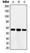 Cytochrome P450 Family 3 Subfamily A Member 7 antibody, MBS820608, MyBioSource, Western Blot image 