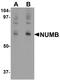 NUMB Endocytic Adaptor Protein antibody, A01206, Boster Biological Technology, Western Blot image 