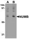 Protein numb homolog antibody, A01206, Boster Biological Technology, Western Blot image 