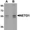 Neuropilin and tolloid-like protein 1 antibody, LS-C144416, Lifespan Biosciences, Western Blot image 