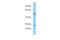 Sorting Nexin 2 antibody, A04493, Boster Biological Technology, Western Blot image 