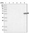 Citrate Synthase antibody, NBP2-13878, Novus Biologicals, Western Blot image 