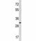 Myristoylated Alanine Rich Protein Kinase C Substrate antibody, F48081-0.4ML, NSJ Bioreagents, Western Blot image 