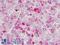Hexokinase 1 antibody, LS-B9026, Lifespan Biosciences, Immunohistochemistry frozen image 