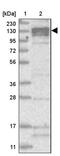 ATPase Phospholipid Transporting 11B (Putative) antibody, PA5-57578, Invitrogen Antibodies, Western Blot image 